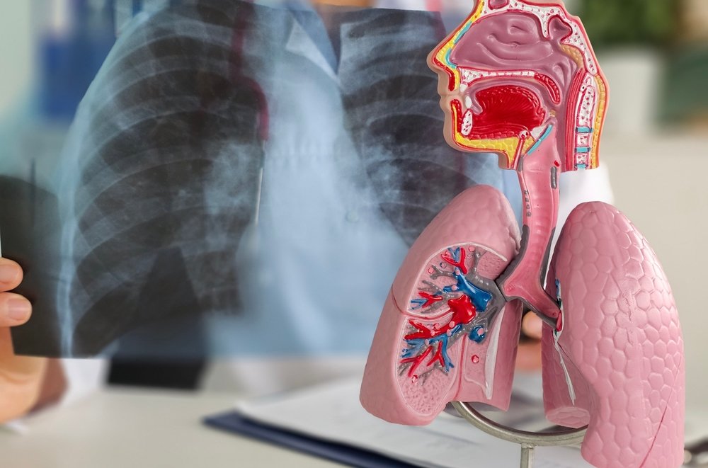 Living With COPD and Other Chronic Conditions