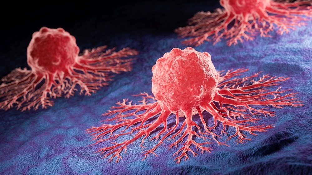 MCED Cancer Screening Trials: What are the Options?